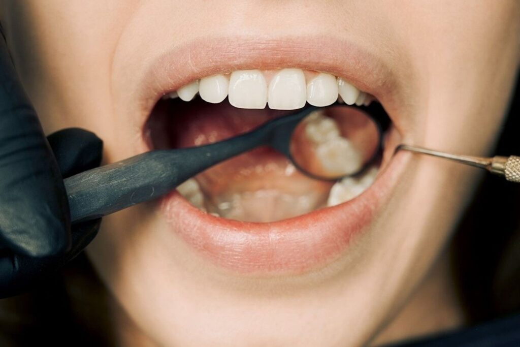 Frau mit offenem Mund beim Zahnarzt