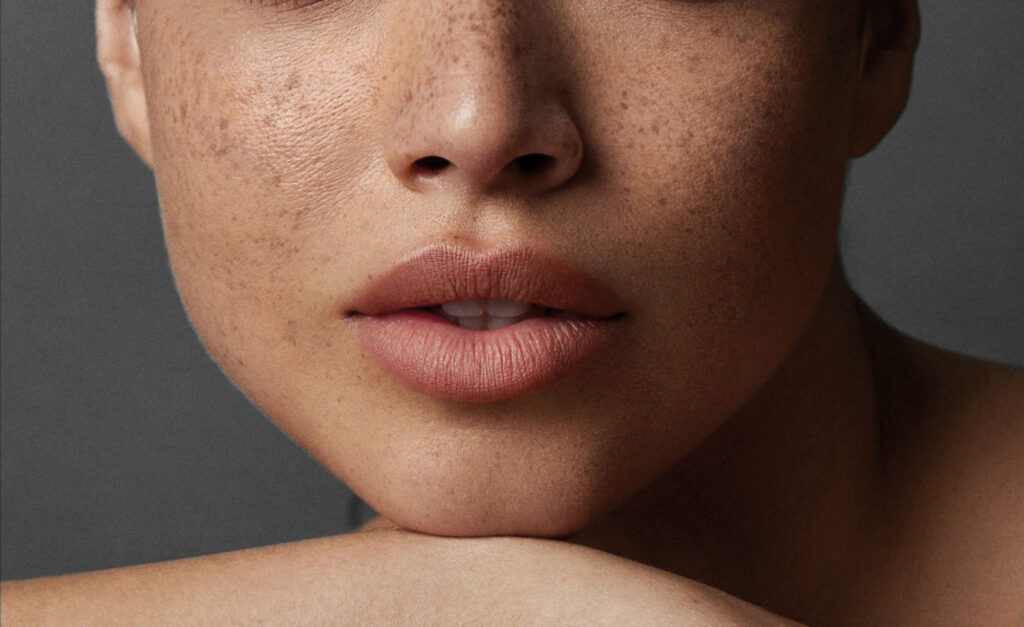 Permanent Make-Up: Mundpartie von einer Frau mit Sommersprossen im Gesicht