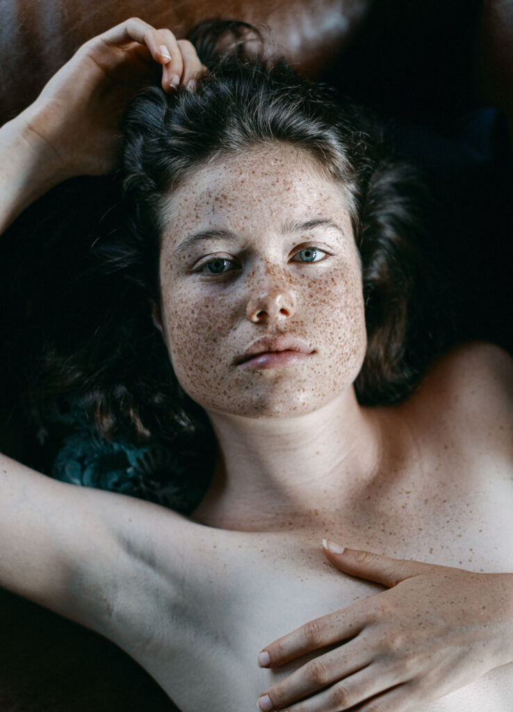 Akt-Foto von einer jungen Frau mit vielen Sommersprossen im Gesicht.