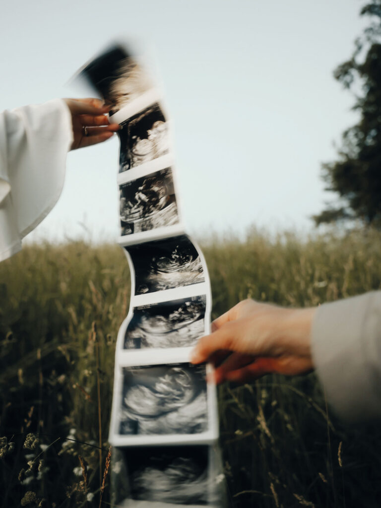 Ultraschall-Bilder von einem Baby mit Feld im Hintergrund